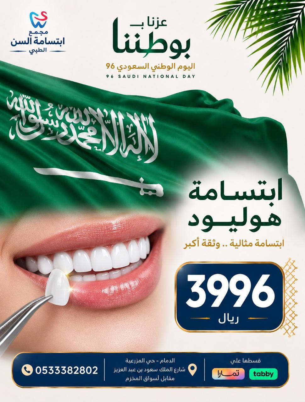 ابتسامة هوليود